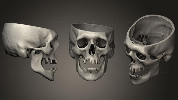 Анатомия скелеты и черепа (Череп Мужской 51yo69, ANTM_1290) 3D модель для ЧПУ станка